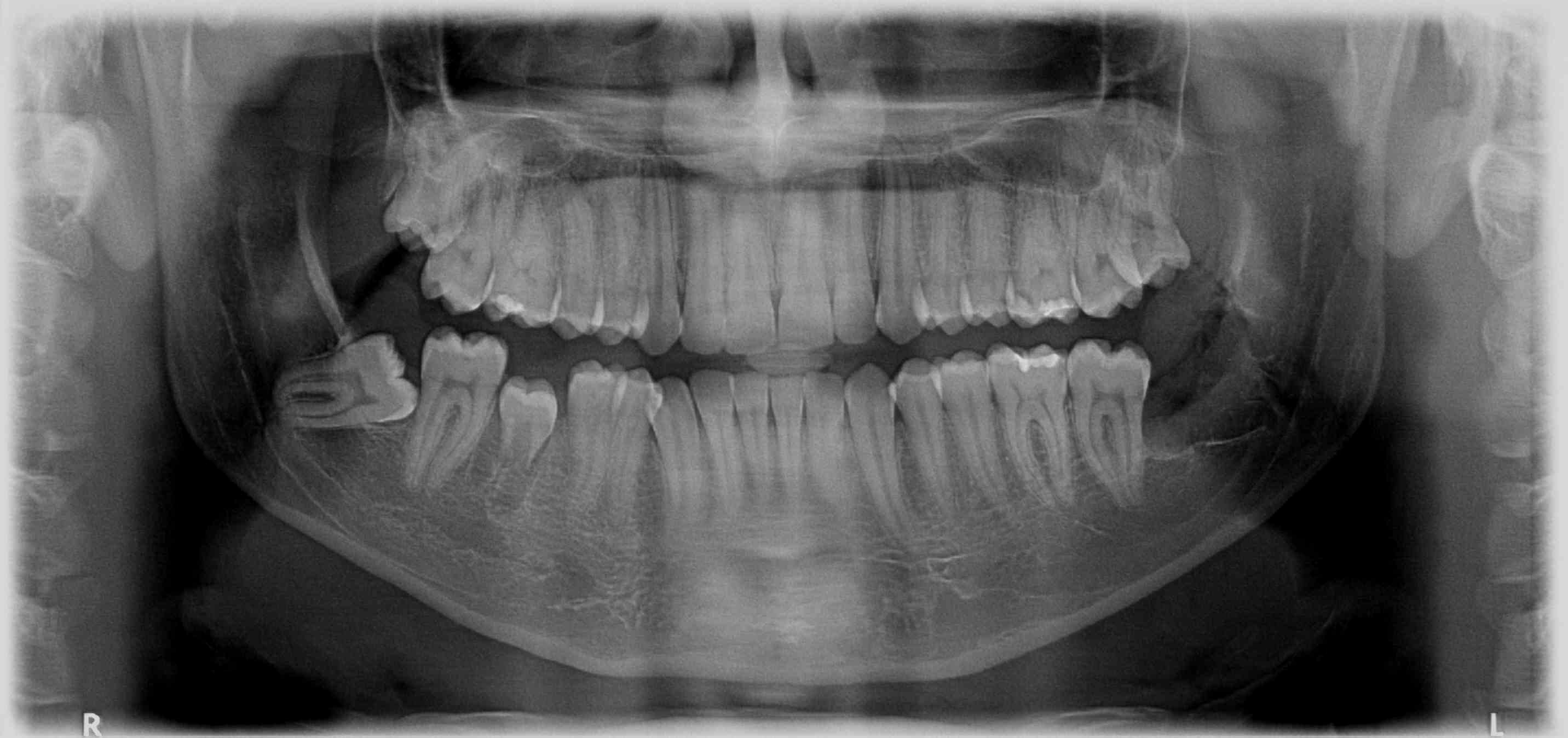 radiografia panorâmica